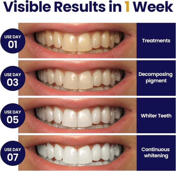 Professional Teeth Whitening Strips - Image 5