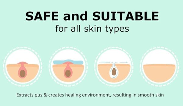 Pimple Patches 72 Spot - Image 6
