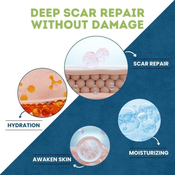 Silicone Scar Sheets - Image 2